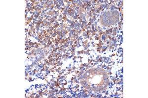Immunohistochemistry of paraffin-embedded human appendix using V Rabbit mAb (ABIN7271304) at dilution of 1:100 (40x lens). (VAV2 抗体)