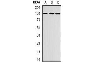 Western blot analysis of EPHB1/2 expression in K562 (A), NIH3T3 (B), HEK293T (C) whole cell lysates. (EPHB1/2 抗体)