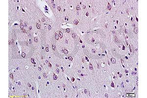 Formalin-fixed and paraffin embedded rat brain tissue labeled with Anti-E2F1 Polyclonal Antibody (ABIN670686), Unconjugated at 1:200, followed by conjugation to the secondary antibody and DAB staining (E2F1 抗体  (AA 101-180))