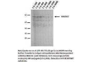 Image no. 2 for anti-Proteasome (Prosome, Macropain) 26S Subunit, Non-ATPase, 14 (PSMD14) antibody (ABIN108607) (PSMD14 抗体)