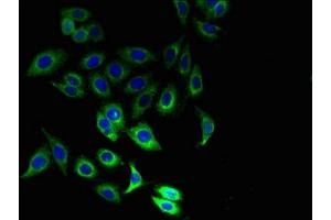 Immunofluorescent analysis of Hela cells using ABIN7156679 at dilution of 1:100 and Alexa Fluor 488-congugated AffiniPure Goat Anti-Rabbit IgG(H+L) (IFITM1 抗体  (AA 1-36))