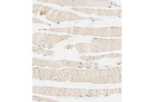 Immunohistochemical analysis of paraffin-embedded human skeletal muscle tissue using C performed on the Leica® BOND RXm. (Glucosylceramidase 抗体  (Center))