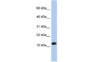 WB Suggested Anti-RPL30 Antibody Titration: 0. (RPL30 抗体  (Middle Region))