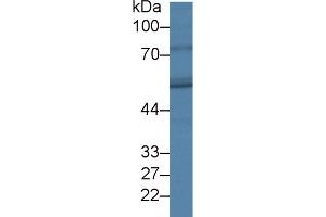 Detection of FADS3 in Porcine Stomach lysate using Polyclonal Antibody to Fatty Acid Desaturase 3 (FADS3) (FADS3 抗体  (AA 331-445))