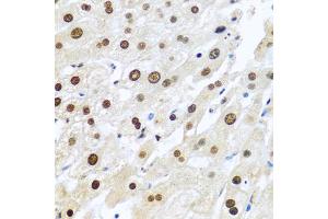 Immunohistochemistry of paraffin-embedded human liver using METTL3 antibody. (METTL3 抗体)