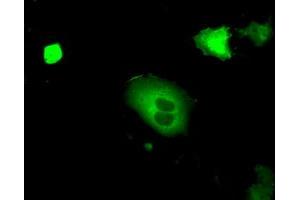 Anti-PRKG1 mouse monoclonal antibody (ABIN2453516) immunofluorescent staining of COS7 cells transiently transfected by pCMV6-ENTRY PRKG1 (RC220986).