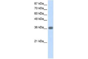 KLHDC8A antibody used at 1. (KLHDC8A 抗体  (C-Term))