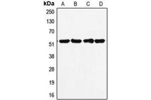 Western blot analysis of p53 expression in MDAMB231 (A), HepG2 (B), MCF7 (C), A431 (D) whole cell lysates. (p53 抗体  (C-Term))