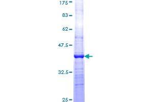 Image no. 1 for Glypican 3 (GPC3) (AA 301-400) protein (GST tag) (ABIN1355526)
