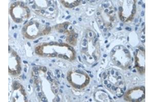 Immunohistochemistry (IHC) image for anti-Transforming Growth Factor, beta-Induced, 68kDa (TGFBI) (AA 423-632) antibody (ABIN7431149)