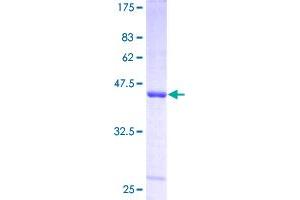 SAT1 Protein (AA 1-171) (GST tag)