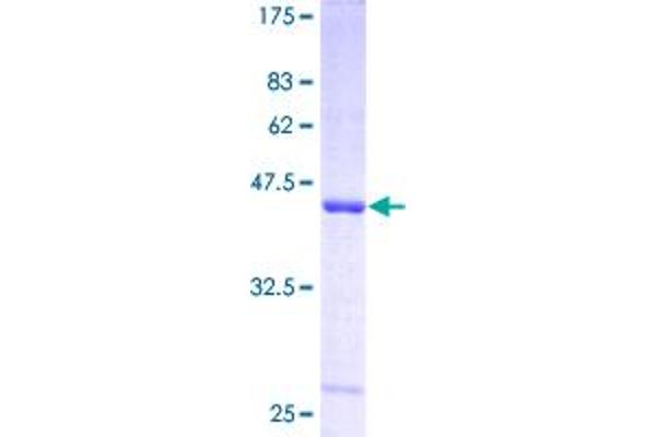 SAT1 Protein (AA 1-171) (GST tag)