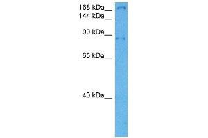 Host:  Rabbit  Target Name:  LAMB1  Sample Tissue:  Mouse Heart  Antibody Dilution:  1ug/ml (Laminin beta 1 抗体  (Middle Region))