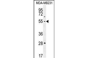 Western blot analysis in MDA-MB231 cell line lysates (35ug/lane). (MMP1 抗体  (AA 317-347))