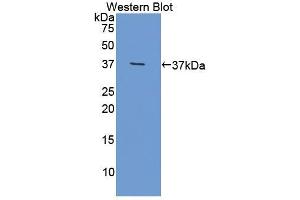 Detection of Recombinant OLFM4, Mouse using Polyclonal Antibody to Olfactomedin 4 (OLFM4) (Olfactomedin 4 抗体  (AA 238-500))