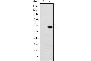 Western blot analysis using RBP4 mAb against HEK293 (1) and RBP4(AA: 1-201)-hIgGFc transfected HEK293 (2) cell lysate. (RBP4 抗体)