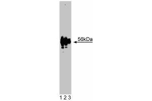 Western blot analysis of Lck on jurkat lysate. (LCK 抗体  (AA 1-191))