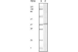 Western blot analysis using KSHV ORF62 mouse mAb against KSHV ORF62 recombinant protein. (KSHVORF62 抗体)