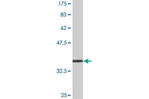 Western Blot detection against Immunogen (35. (PHACTR2 抗体  (AA 56-143))