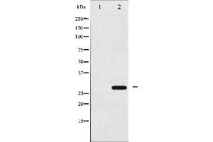 Western blot analysis of 14-3-3 zeta phosphorylation expression in UV treated NIH-3T3 whole cell lysates,The lane on the left is treated with the antigen-specific peptide. (14-3-3 zeta 抗体  (pSer58))