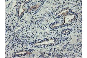 Image no. 4 for anti-C-Type Lectin Domain Family 4, Member E (CLEC4E) antibody (ABIN1497530)