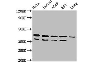 Western Blot Positive WB detected in: Hela whole cell lysate, Jurkat whole cell lysate, A549 whole cell lysate, 293 whole cell lysate, Rat lung tissue All lanes: MAPK1 antibody at 4. (ERK2 抗体  (AA 310-360))