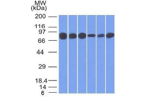 Western Blot of HT20, 293, A431, MCF-7, HepG2 and A549 cell lysates using Catenin, gamma Mouse Monoclonal Antibody (15F11). (JUP 抗体)