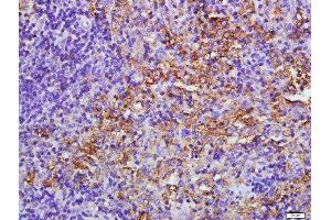 Paraformaldehyde-fixed, paraffin embedded mouse spleen tissue, Antigen retrieval by boiling in sodium citrate buffer(pH6) for 15min, Block endogenous peroxidase by 3% hydrogen peroxide for 30 minutes, Blocking buffer (normal goat serum) at 37°C for 20min, Antibody incubation with Rabbit Anti-EIF2AK2/PKR Polyclonal Antibody, Unconjugated  at 1:500 overnight at 4°C, followed by a conjugated secondary and DAB staining (E2AK2/PKR 抗体  (AA 251-360))