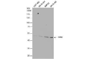 WB Image TPH2 antibody detects TPH2 protein by western blot analysis. (Tryptophan Hydroxylase 2 抗体)