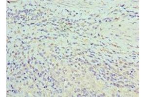 Immunohistochemistry of paraffin-embedded human epityphlon tissue using ABIN7155295 at dilution of 1:100 (ASF1A 抗体  (AA 1-204))