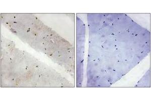 Immunohistochemistry analysis of paraffin-embedded human skeletal muscle tissue, using LATS2 Antibody.