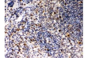 Immunohistochemistry (IHC) image for anti-Spleen Focus Forming Virus (SFFV) Proviral Integration Oncogene Spi1 (SPI1) (AA 18-196) antibody (ABIN3043440)