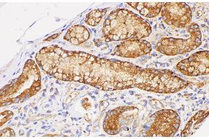 Immunohistochemistry of paraffin-embedded Human duodenum using CD38 Polycloanl Antibody at dilution of 1:200 (CD38 抗体)