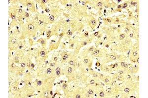 IHC image of ABIN7143616 diluted at 1:350 and staining in paraffin-embedded human liver tissue performed on a Leica BondTM system. (ALT 抗体  (AA 2-496))