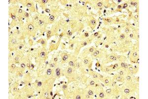 IHC image of ABIN7143616 diluted at 1:350 and staining in paraffin-embedded human liver tissue performed on a Leica BondTM system. (ALT 抗体  (AA 2-496))