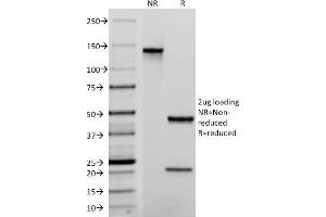 SDS-PAGE Analysis Purified TACSTD2 / TROP2 Mouse Monoclonal Antibody (TACSTD2/2152). (TACSTD2 抗体  (AA 31-274))