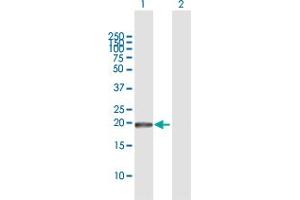 Western Blot analysis of GUK1 expression in transfected 293T cell line by GUK1 MaxPab polyclonal antibody. (GUK1 抗体  (AA 1-197))