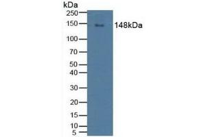 Detection of PLCg2 in Human Raji Cells using Polyclonal Antibody to Phospholipase C Gamma 2, Phosphatidylinositol Specific (PLCg2) (Phospholipase C gamma 2 抗体  (AA 930-1152))