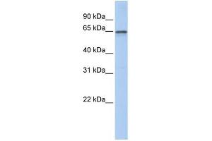 Human Brain; WB Suggested Anti-AHCYL1 Antibody Titration: 0. (AHCYL1 抗体  (N-Term))
