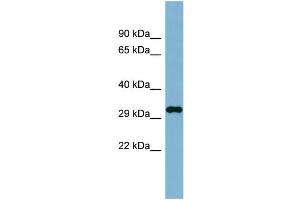 WB Suggested Anti-C20orf116 Antibody Titration:  0. (DDRGK1 抗体  (N-Term))