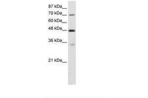 Image no. 2 for anti-Cysteinyl-tRNA Synthetase (CARS) (AA 661-710) antibody (ABIN6736226) (CARS 抗体  (AA 661-710))