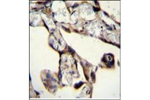 Immunohistochemistry (Paraffin-embedded Sections) (IHC (p)) image for anti-SAM and SH3 Domain Containing 1 (SASH1) (AA 603-633), (Middle Region) antibody (ABIN954673)