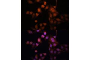 Immunofluorescence analysis of HeLa cells using Twist antibody (ABIN6128846, ABIN6149715, ABIN6149718 and ABIN6223153) at dilution of 1:100. (TWIST1 抗体  (AA 103-202))