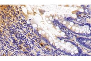 Detection of SIRT3 in Rat Colon Tissue using Polyclonal Antibody to Sirtuin 3 (SIRT3) (SIRT3 抗体  (AA 127-303))