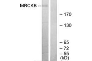 Western blot analysis of extracts from COLO cells, using MRCKB Antibody. (CDC42BPB 抗体  (AA 1641-1690))