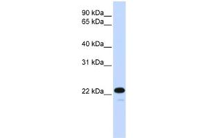 WB Suggested Anti-CDKN1B Antibody Titration:  0. (CDKN1B 抗体  (C-Term))