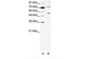 Image no. 1 for anti-Sirtuin 3 (SIRT3) (AA 152-201) antibody (ABIN203108) (SIRT3 抗体  (AA 152-201))