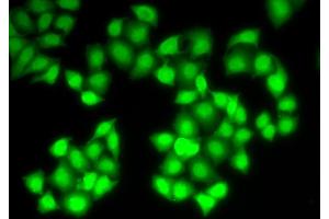 Immunofluorescence analysis of HeLa cells using DNASE1 antibody (ABIN5971366). (DNASE1 抗体)
