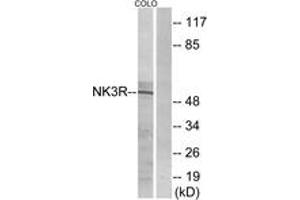 Western blot analysis of extracts from COLO205 cells, using NK3R Antibody. (TACR3 抗体  (AA 401-450))