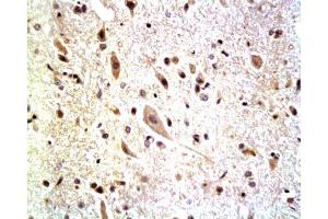 Immunohistochemistry (Paraffin-embedded Sections) (IHC (p)) image for anti-Neurofascin (NFASC) (AA 501-650) antibody (ABIN727325)